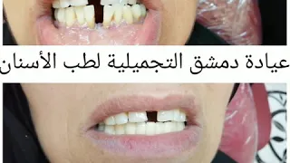 عيادة دمشق التجميلية لطب الأسنان في سلطنة عمان ولاية عبري الواقعة مقابل اللولو القديم 📱 ٧٩٢٢٠٧٠٣