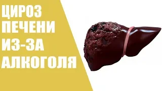 Цирроз печени из-за алкоголя