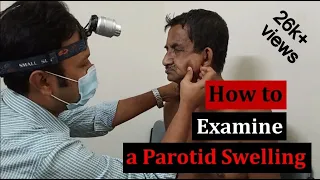 Clinical Examination of a Parotid Gland Swelling: Step by Step Demonstration
