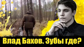 Влад Бахов. Зубы где? Влад Бахов последние новости. Бахов сегодня!