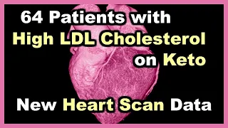 New Heart Scan Data for 64 Participants with high LDL Cholesterol on a Ketogenic Diet
