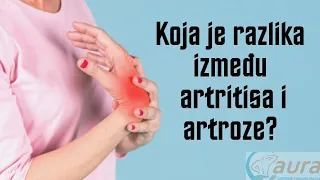 Koja je razlika između artritisa i artroze?