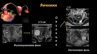 Базовый курс по МРТ  a  Лекция «МР анатомия женского таза и методика сбора данных»  Трофименко И А