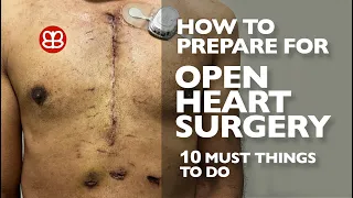 How to Prepare for Open Heart Surgery | 10 Must Things To Do To Prepare | Heart, Valve & Surgery