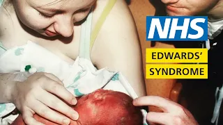 What it's like to have a baby with Edwards' syndrome - My Story - Chloe and Penelope | NHS