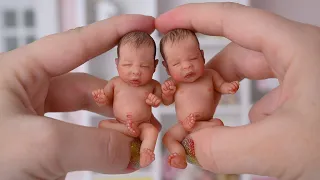 Remember the smallest twins in the world? This is what has become of them now!