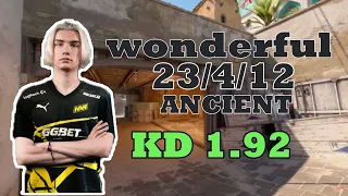 wonderful vs FPL (Dust) | FACEIT Ranked |  #cs2 #pov