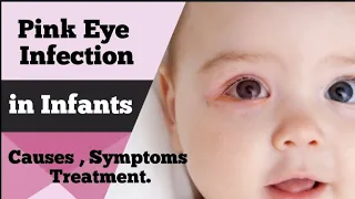 Pink Eye Infection in Newborn Causes , Symptoms and Treatment .