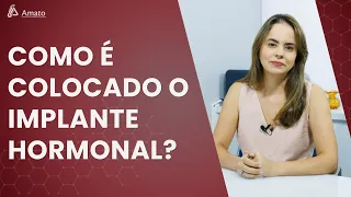 Como é colocado o Implante Hormonal?