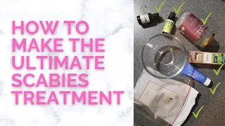 How To Make The Ultimate Scabies Treatment At Home (That Works!)