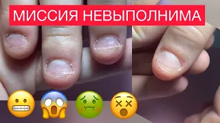 САМЫЕ ОБКУСАННЫЕ 😱 КОРОТКИЕ НОГТИ ГРЫЗУНА 🤔 КАК СДЕЛАТЬ  Наращивание миндаль💅