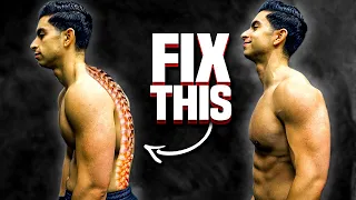 How I “Fixed” My Posture | 10-Minute Mobility Routine