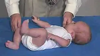 Neurology Exam, 3 Month : Motor - Hand Movements