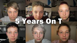 5 Years On Testosterone [ftm/ftx]