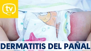 Soluciones para tratar la dermatitis del pañal