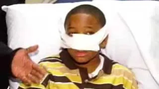 Dog Bites 11-Year-Old Boy In Face