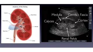 Introduction to Renal Ultrasound