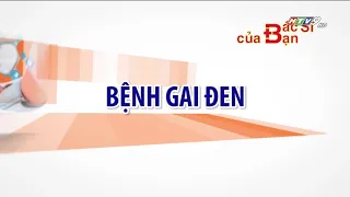 Bệnh gai đen có nguy hiểm không | Bác Sĩ Của Bạn | 2021