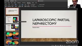 Laproscopic Partial Nephrectomy || Urology ||