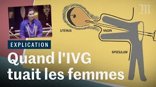 IVG dans la Constitution : quand l'avortement tuait les femmes en France