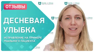 Исправление десневой улыбки 👉 отзыв реального пациента