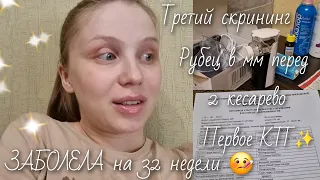 Третий скрининг🤰🏼заболела на 32 недели✨️первое КТГ✨️