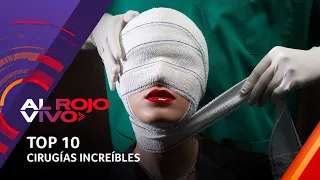 TOP 10: Las cirugías y operaciones más impactantes