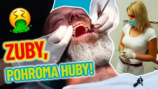 He hadn't been to the dentist in 10 years. What's in his mouth?!
