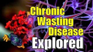Chronic Wasting Disease Explained | Prion disease in humans Explored | Prion disease of Wild Deer
