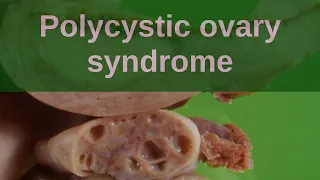 Polycystic Ovary Syndrome - Pathology mini tutorial