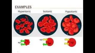 ACHS.edu Hypertonic-Hypotonic by Dr. Jerry Cronin