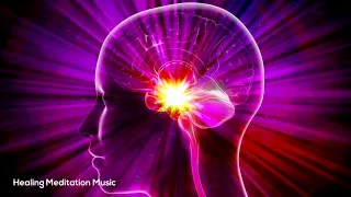 Most Powerful Right Brain Activation Frequency | Subconscious Mind Healing Meditation