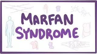 Marfan Syndrome - causes, symptoms, diagnosis, treatment, pathology
