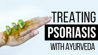 Very effective Psoriasis Treatment in Ayurveda | Dr. Pratap Chauhan | Jiva Ayurveda