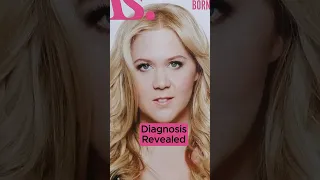 Amy Schumer Shares Diagnosis of Cushing Syndrome #shorts