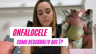 ONFALOCELE - COMO DESCOBRI / O QUE É ?????