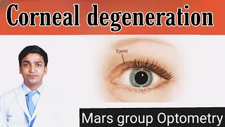 Corneal degeneration. #Cornea