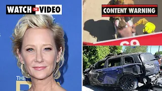 Anne Heche, Ellen DeGeneres’ ex-girlfriend, severely burned after LA crash