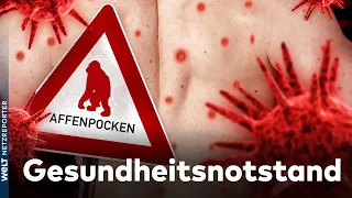 Ausbreitung der Affenpocken: WHO ruft weltweiten Gesundheitsnotstand aus