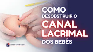 Como desobstruir o CANAL LACRIMAL dos bebês. #maternidade #osteopatia #pediatria #lactantes #saude