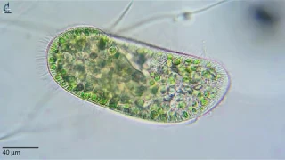 Парамеция бурсария (Paramecium bursaria).