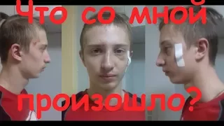 СЛОМАЛИ ЧЕЛЮСТЬ, НОС, СОТРЯСЕНИЕ МОЗГА!!!??? ЧТО СО МНОЙ ПРОИЗОШЛО!