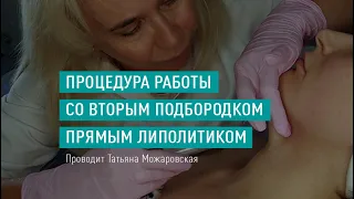 Открытый урок «Процедура работы со вторым подбородком прямым липолитиком»