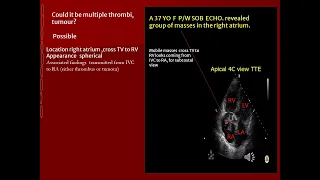 7 Test your skill RA mass Normal variants vs pathologic lesion part 2