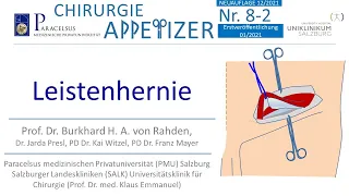 Leistenhernie Inguinalhernie (Shouldice, Lichtenstein, TAPP, TEP etc,) CHIRURGIE APPetizer Nr. 8-2