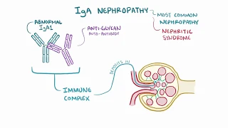 IgA nephropathy Berger disease   causes, symptoms, diagnosis, treatment, pathology