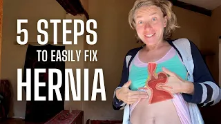 How I Cured Hiatal Hernia in 5 Simple Steps at Home (Natural Remedy)