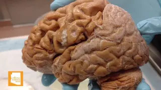 Characteristics Of An Abnormal Brain