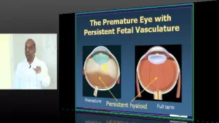 NEETPG Coaching DNB Ophthalmology Topic 01 Anatomy Part 01