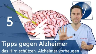 Schutz vor Alzheimer: Diese 5 Tipps sind wichtig zur Vorbeugung der Alzheimererkrankung & der Demenz